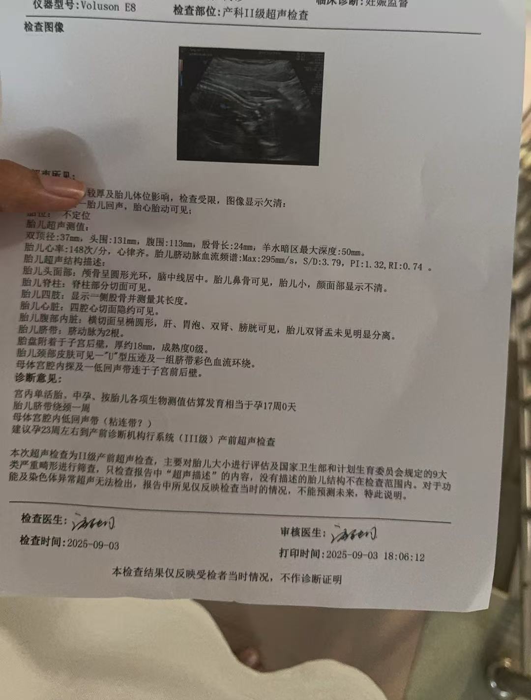 孕期B超检查的烦恼