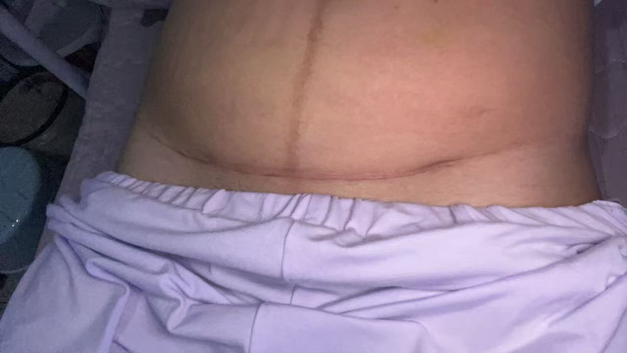 产后恢复与母乳喂养的艰辛