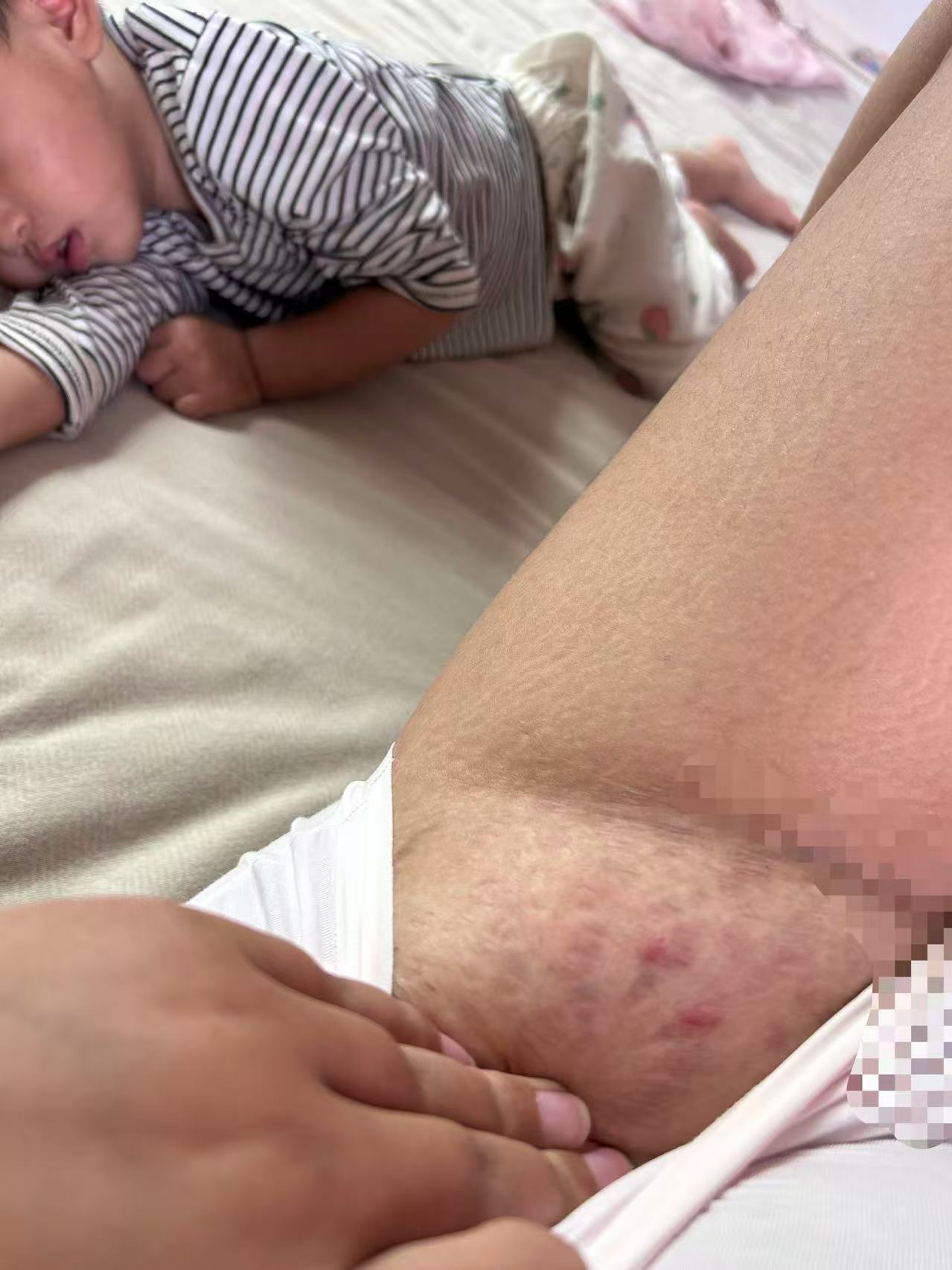 孕期不适与产检经历分享