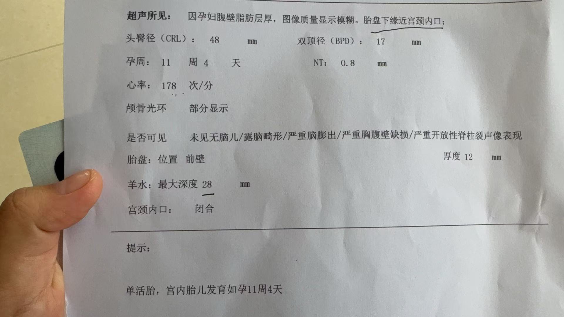 孕期不适与产检经历分享