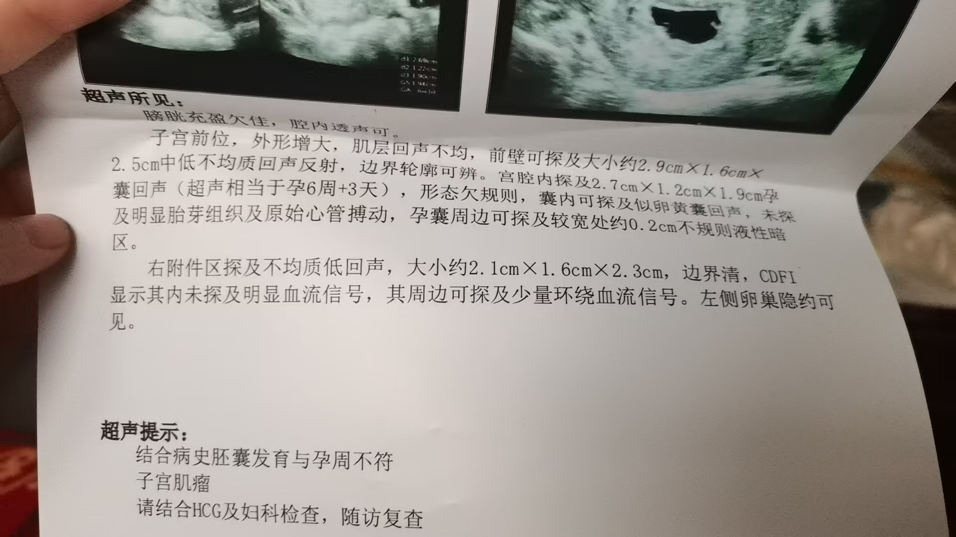 孕期B超检查的困惑与经验分享