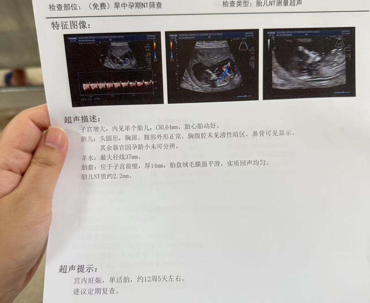 NT检查一次过技巧