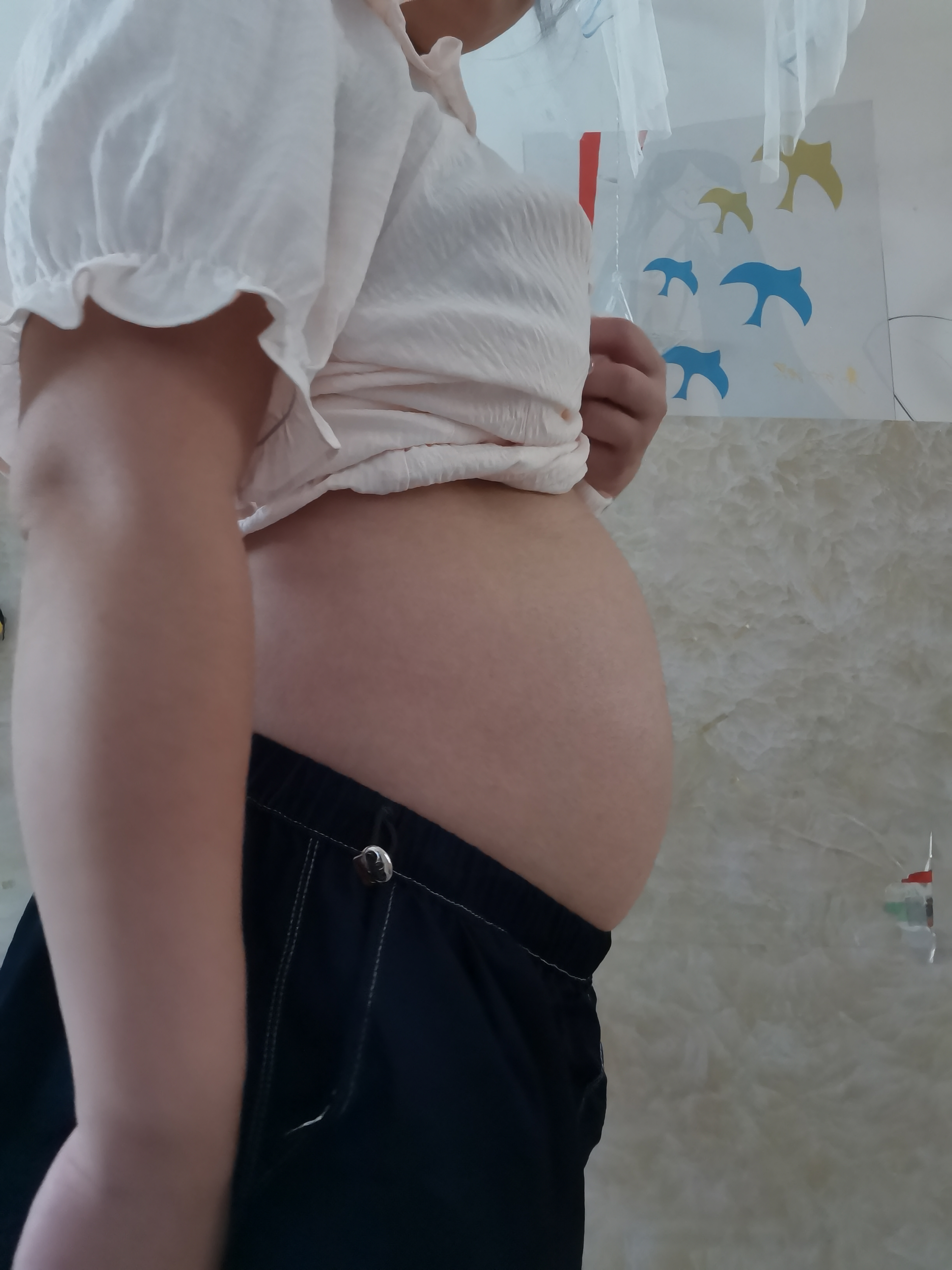 孕期不适与胎动感受