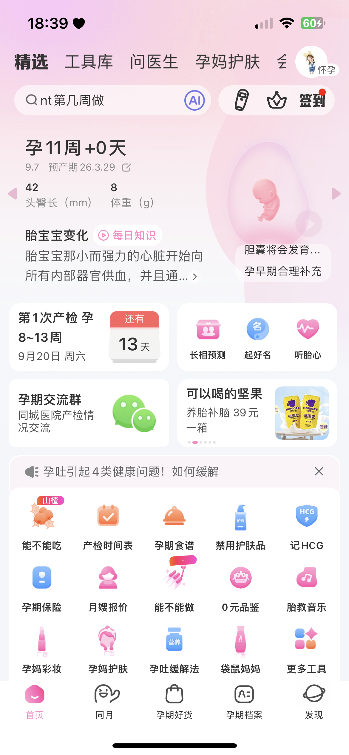 孕期胎动感受分享