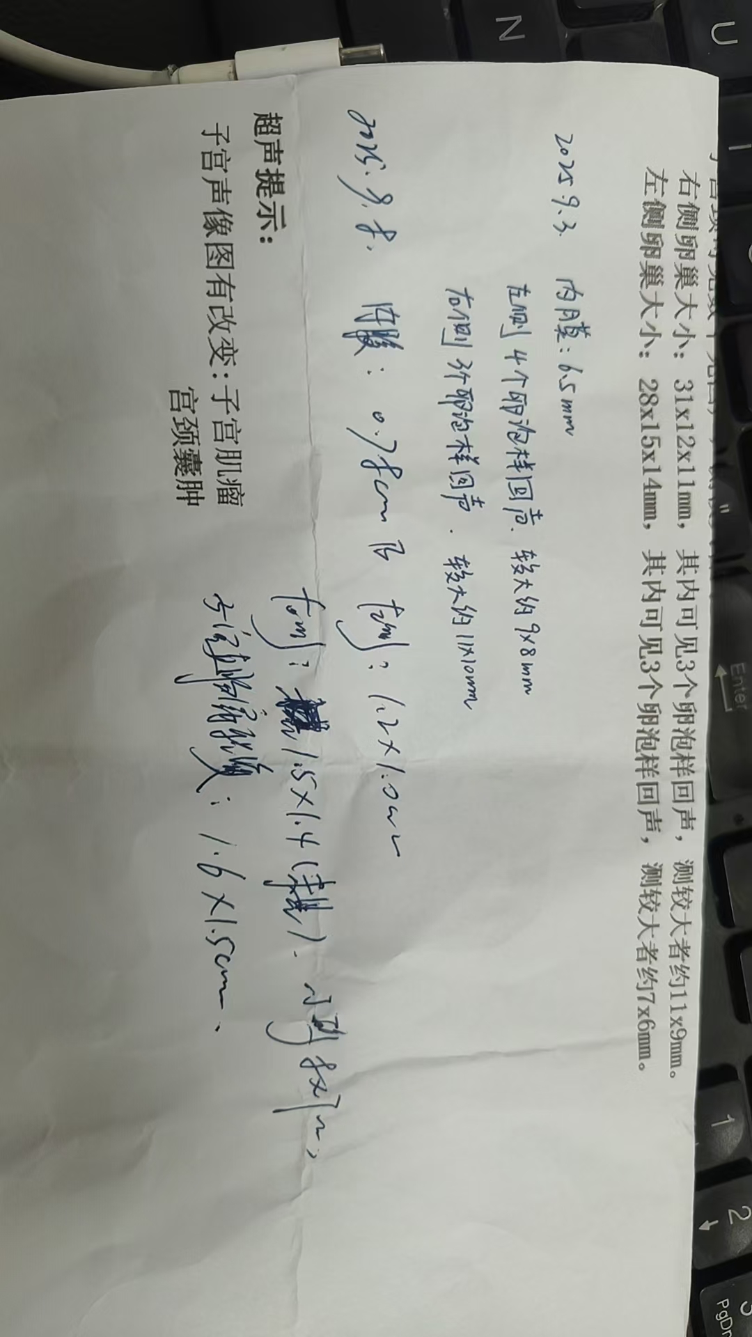 排卵监测的困惑与经验分享