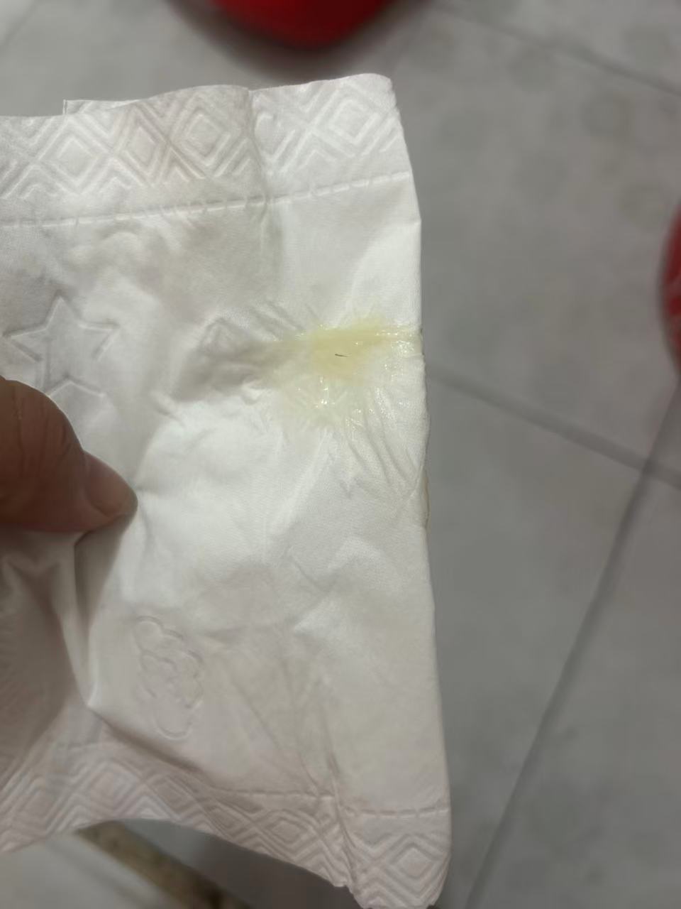 孕晚期白带变化是否预示分娩临近