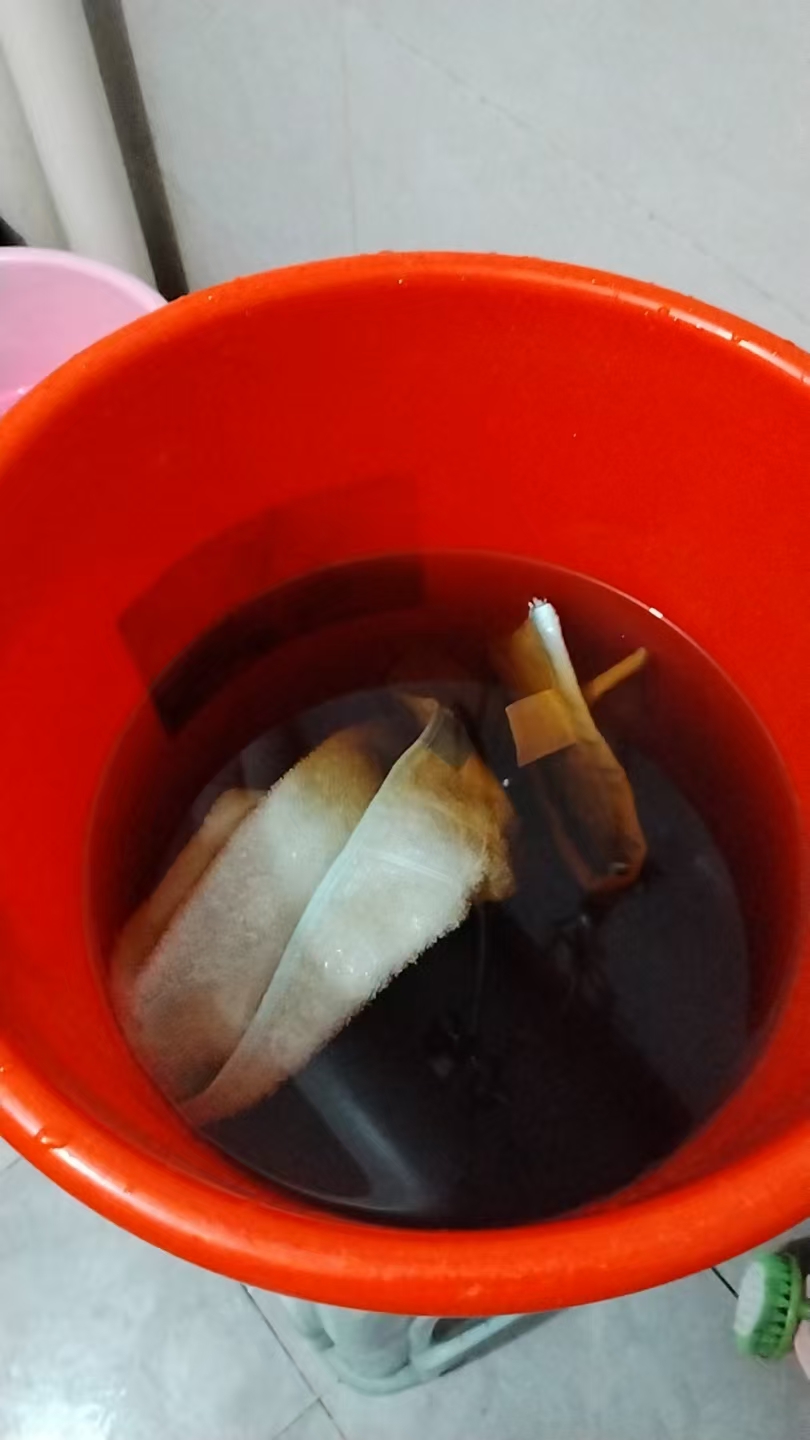 剖腹产后的恢复与护理经验分享