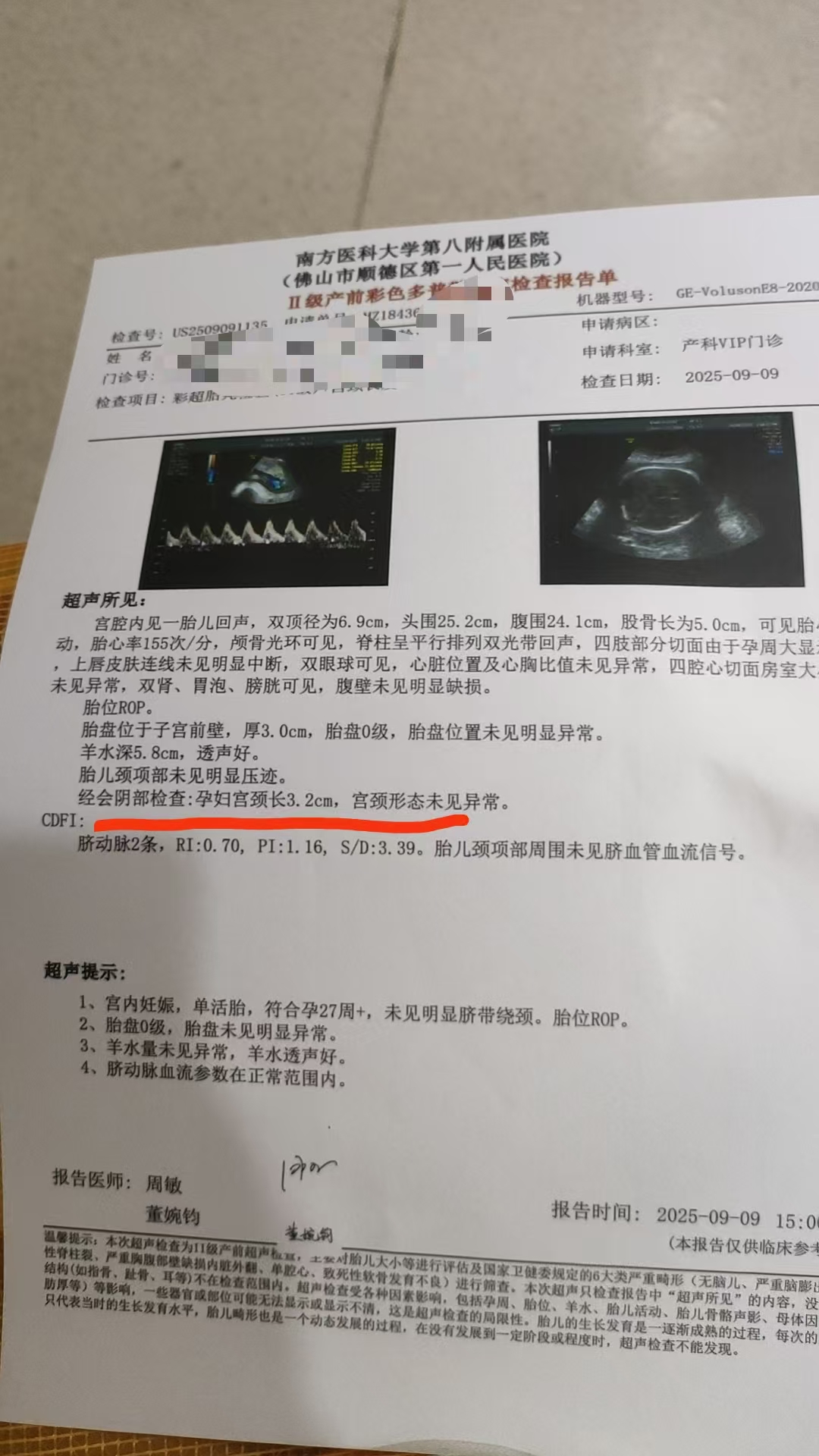 孕期宫颈管检查的重要性