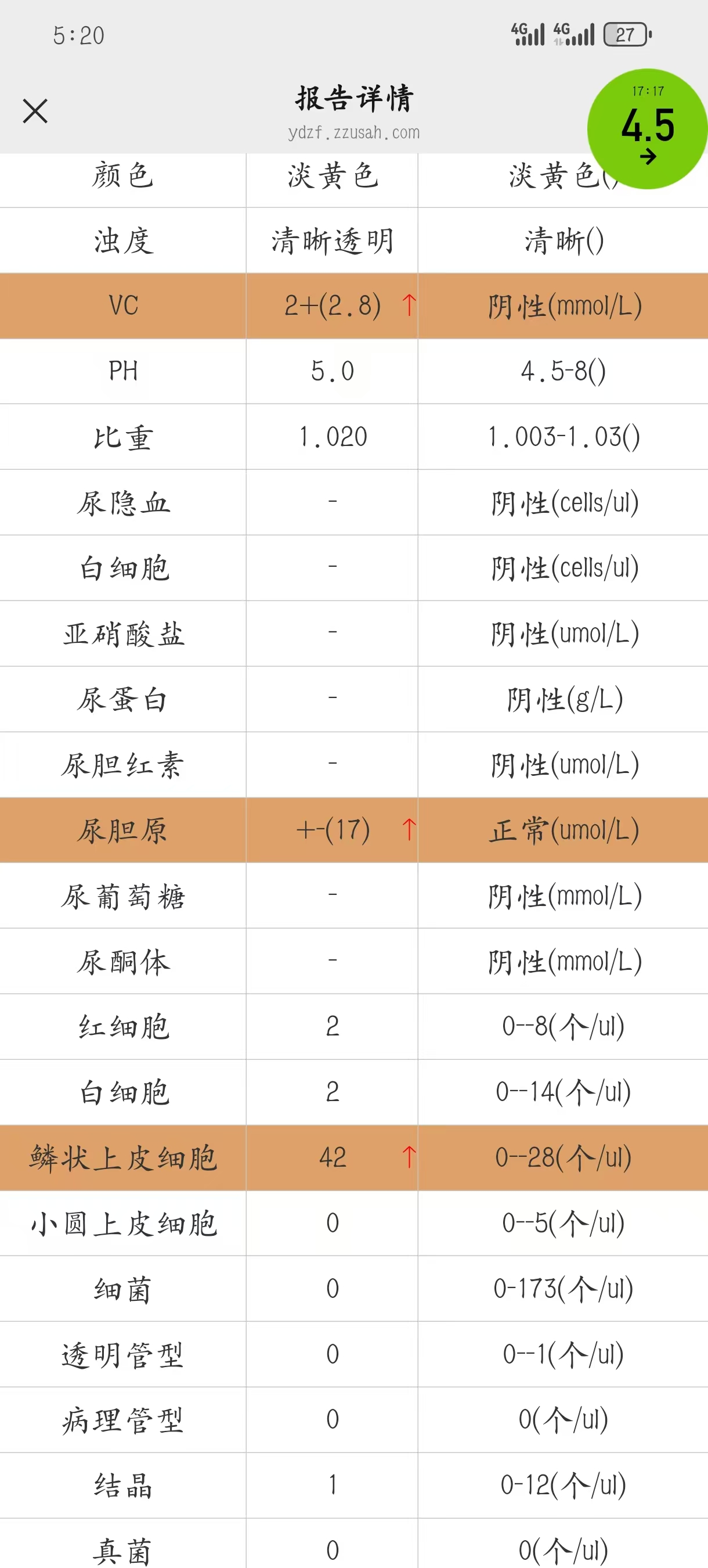 NT检查不顺利的烦恼