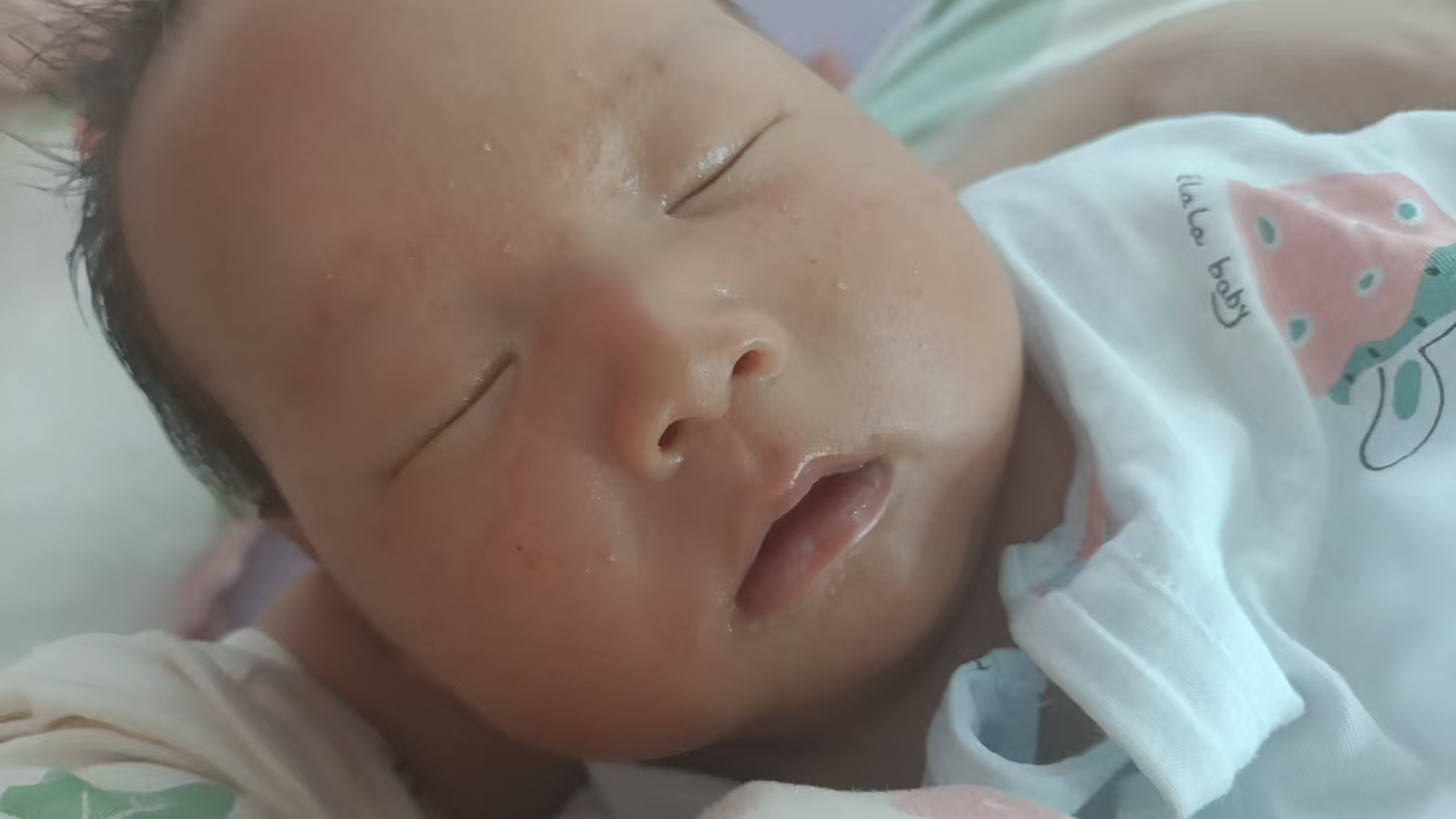 宝宝黄疸反复，晒太阳能缓解吗？