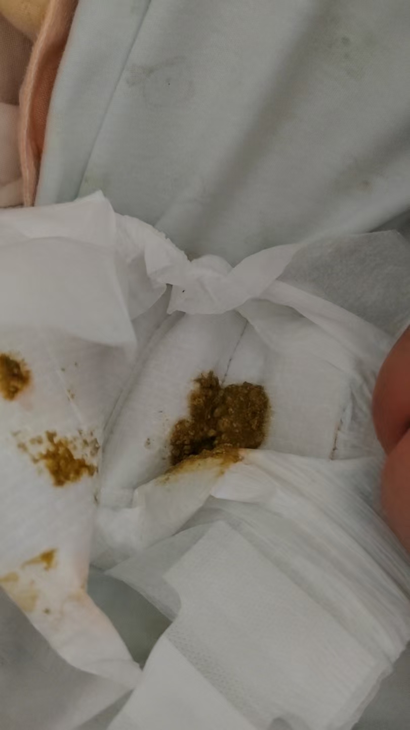 宝宝便便颜色异常怎么办？