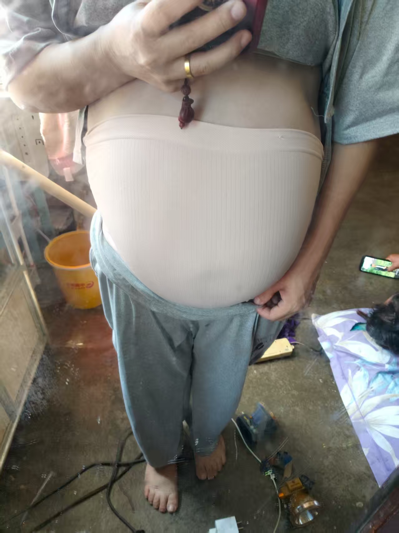 孕期便秘困扰