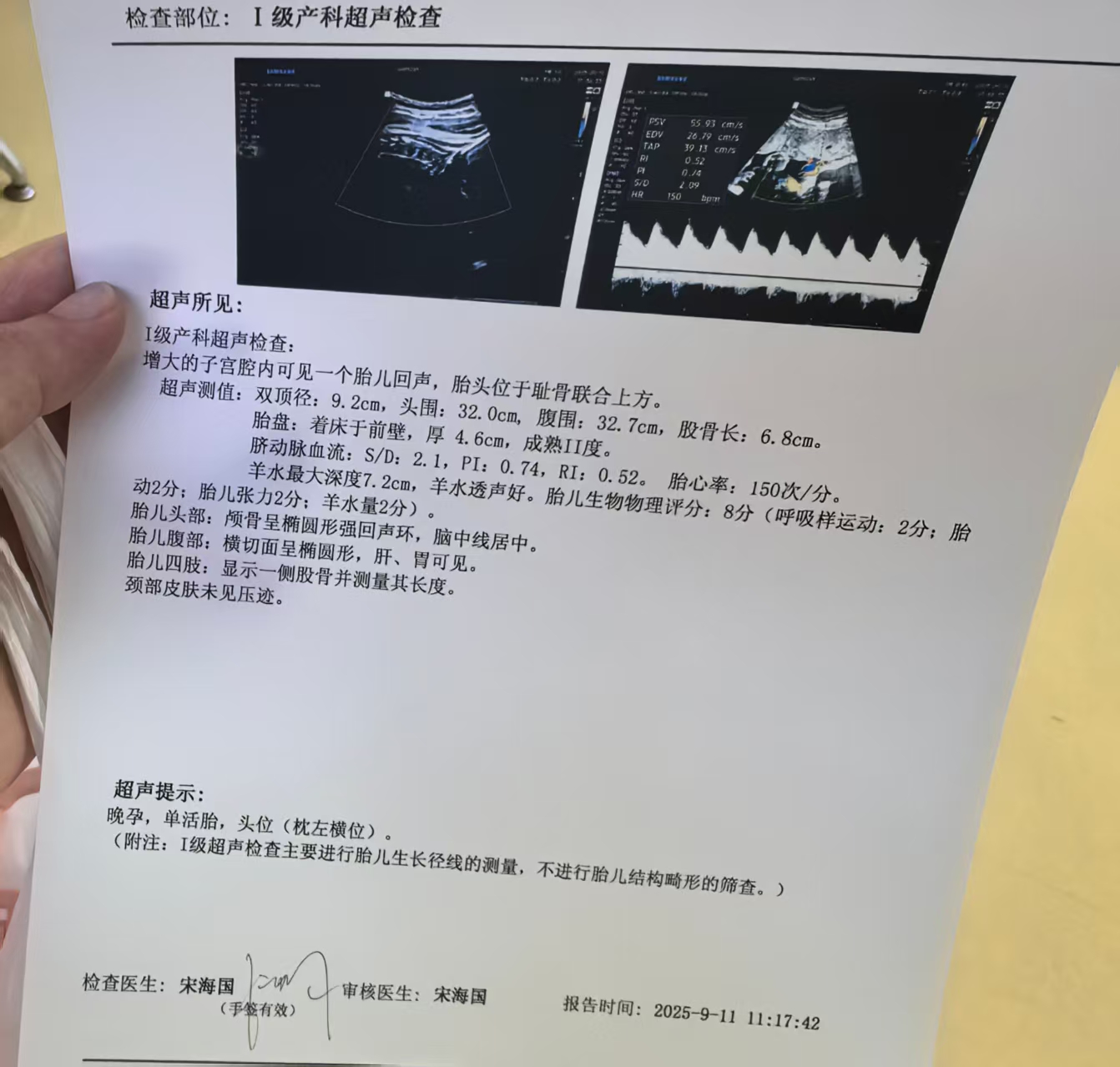孕期体重增长与饮食控制
