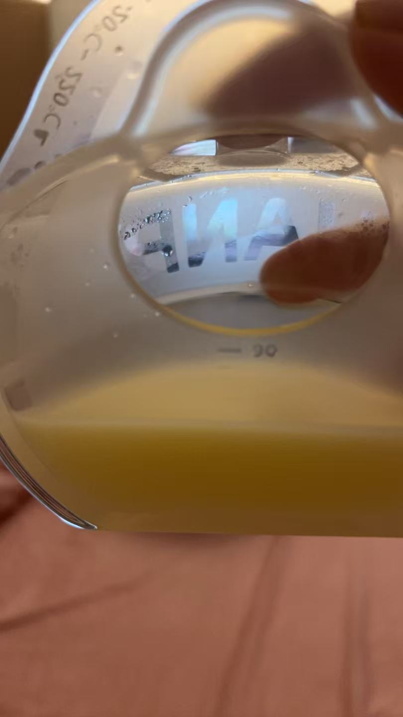 母乳喂养的烦恼与经验分享
