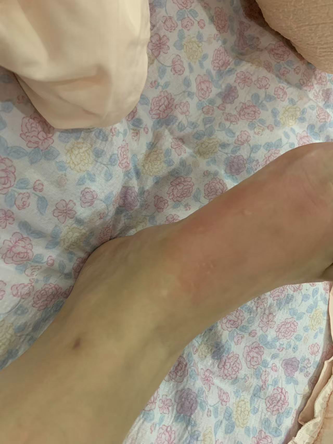 孕期失眠与身体不适的困扰