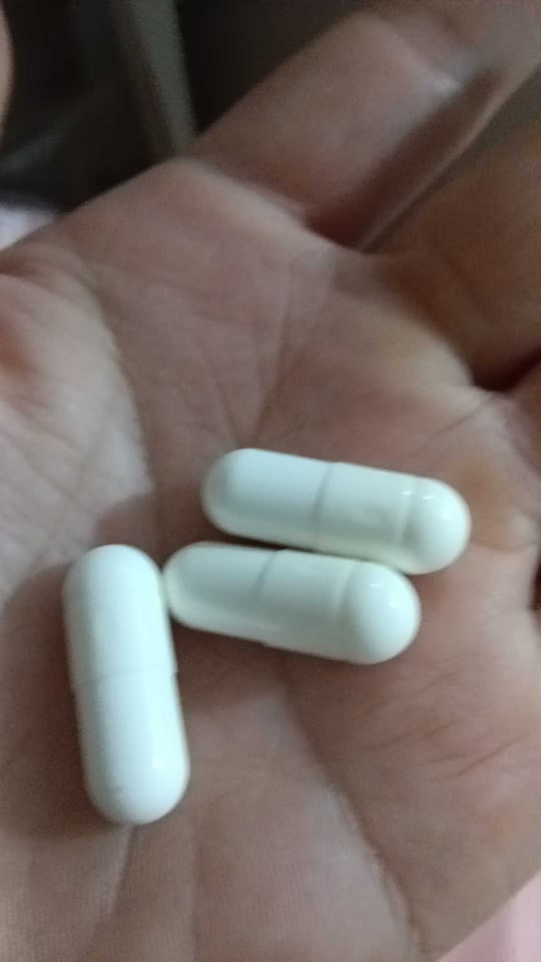 孕期腿痛困扰