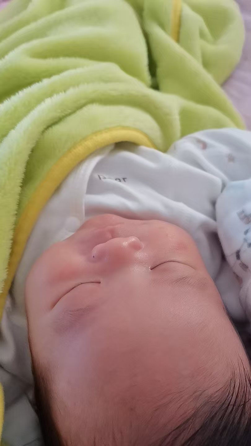 宝宝脸上长疹子怎么办？
