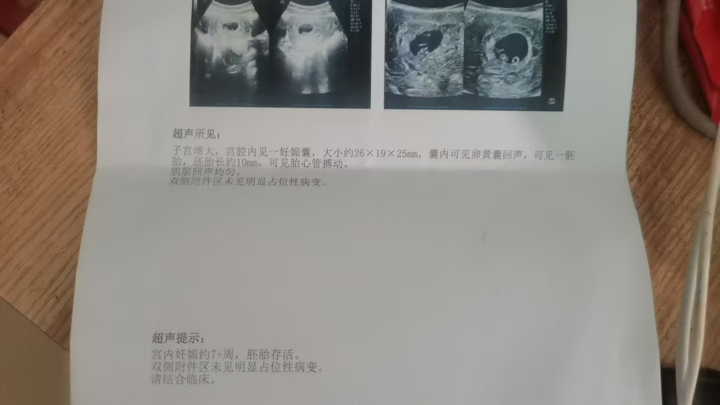 孕早期B超检查的纠结经历