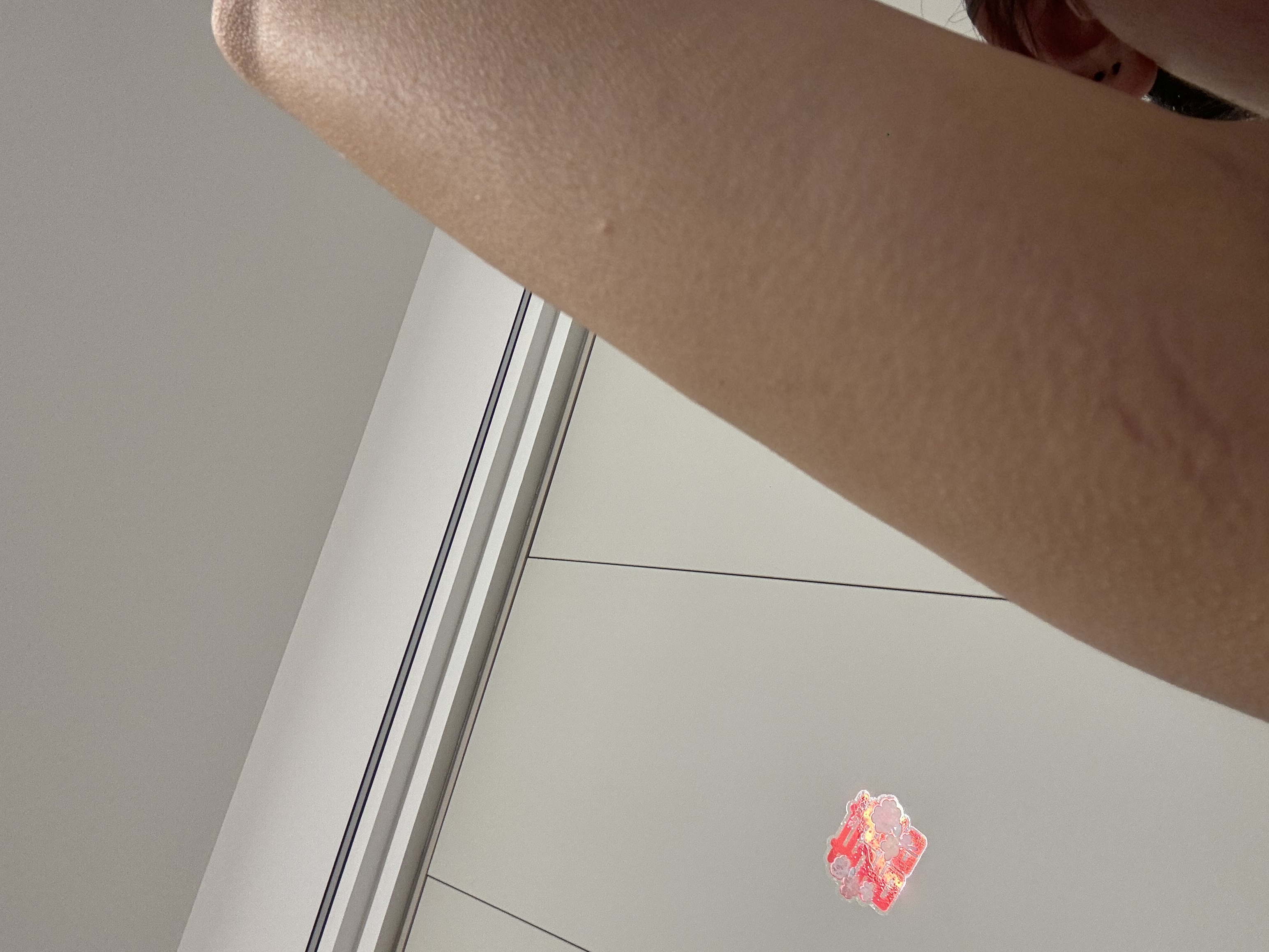 孕期腰酸背痛怎么办？