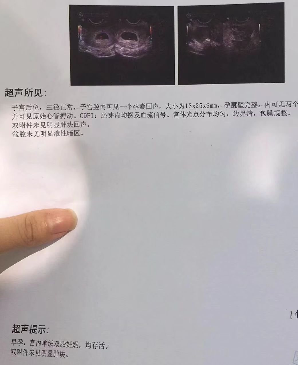 备孕路上的酸甜苦辣