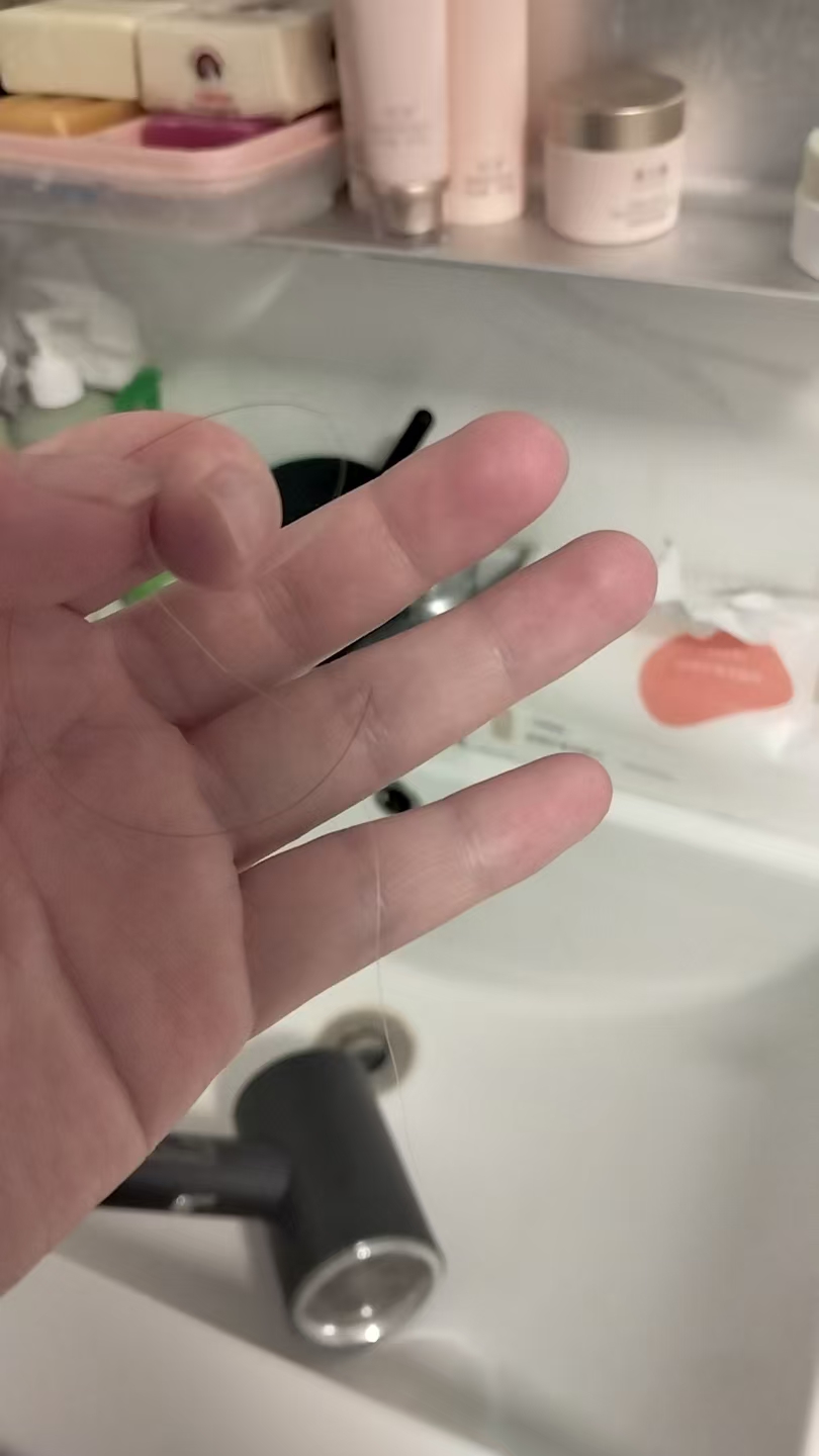 孕期耻骨疼痛的困扰