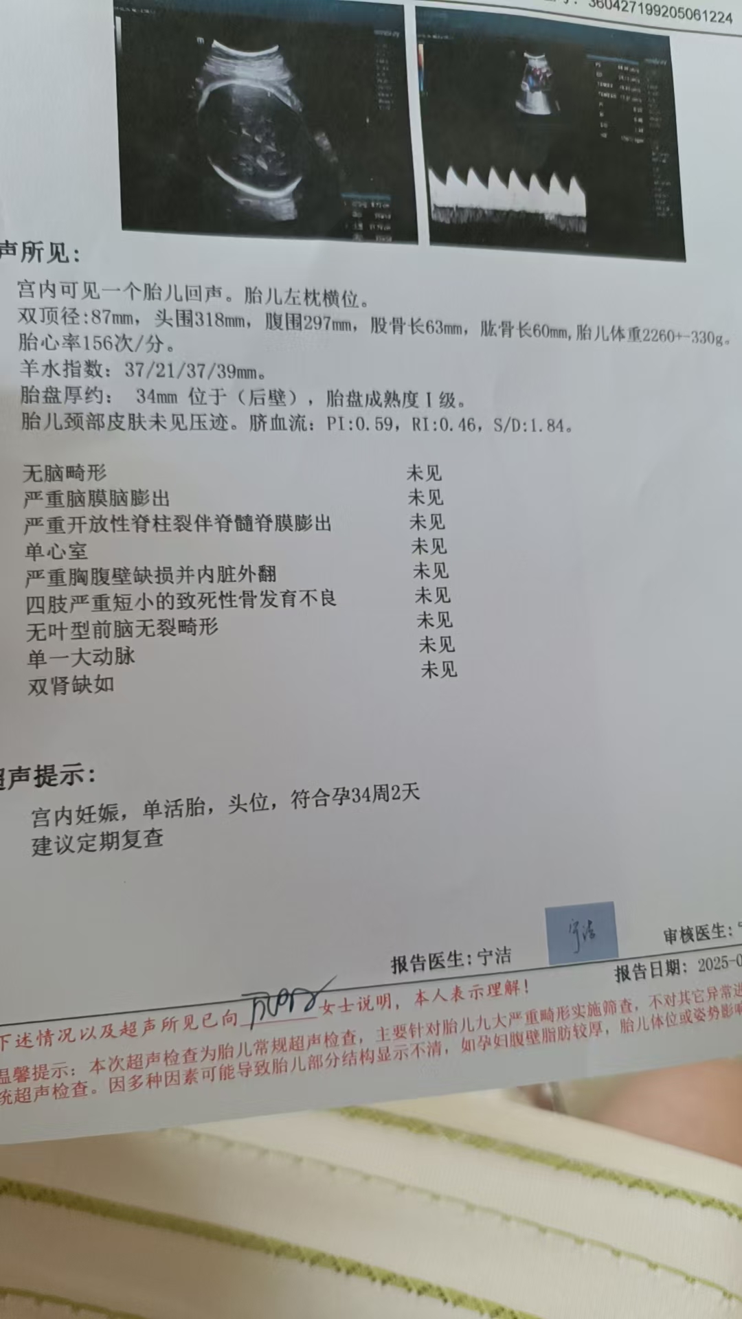 孕期胎监小妙招分享
