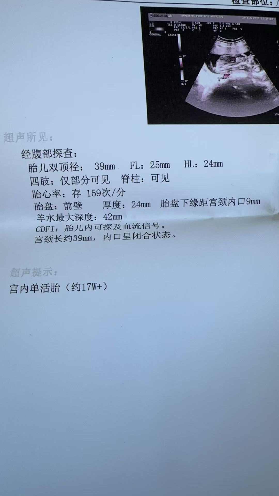 孕期胎盘不稳的困扰与应对