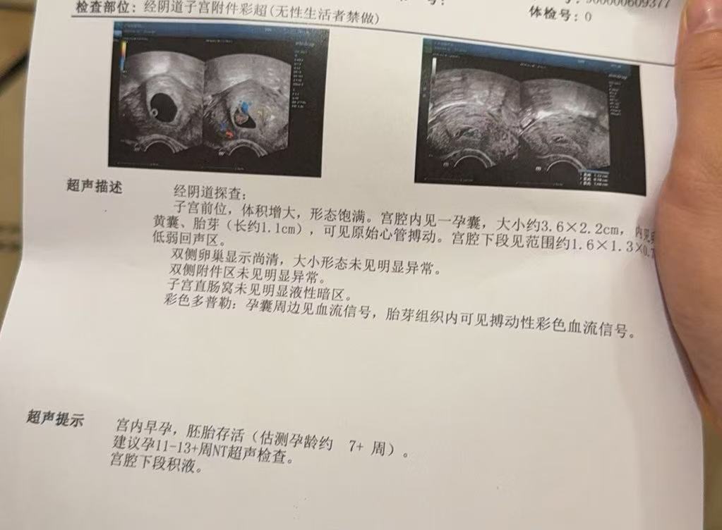 孕早期头晕反胃的困扰