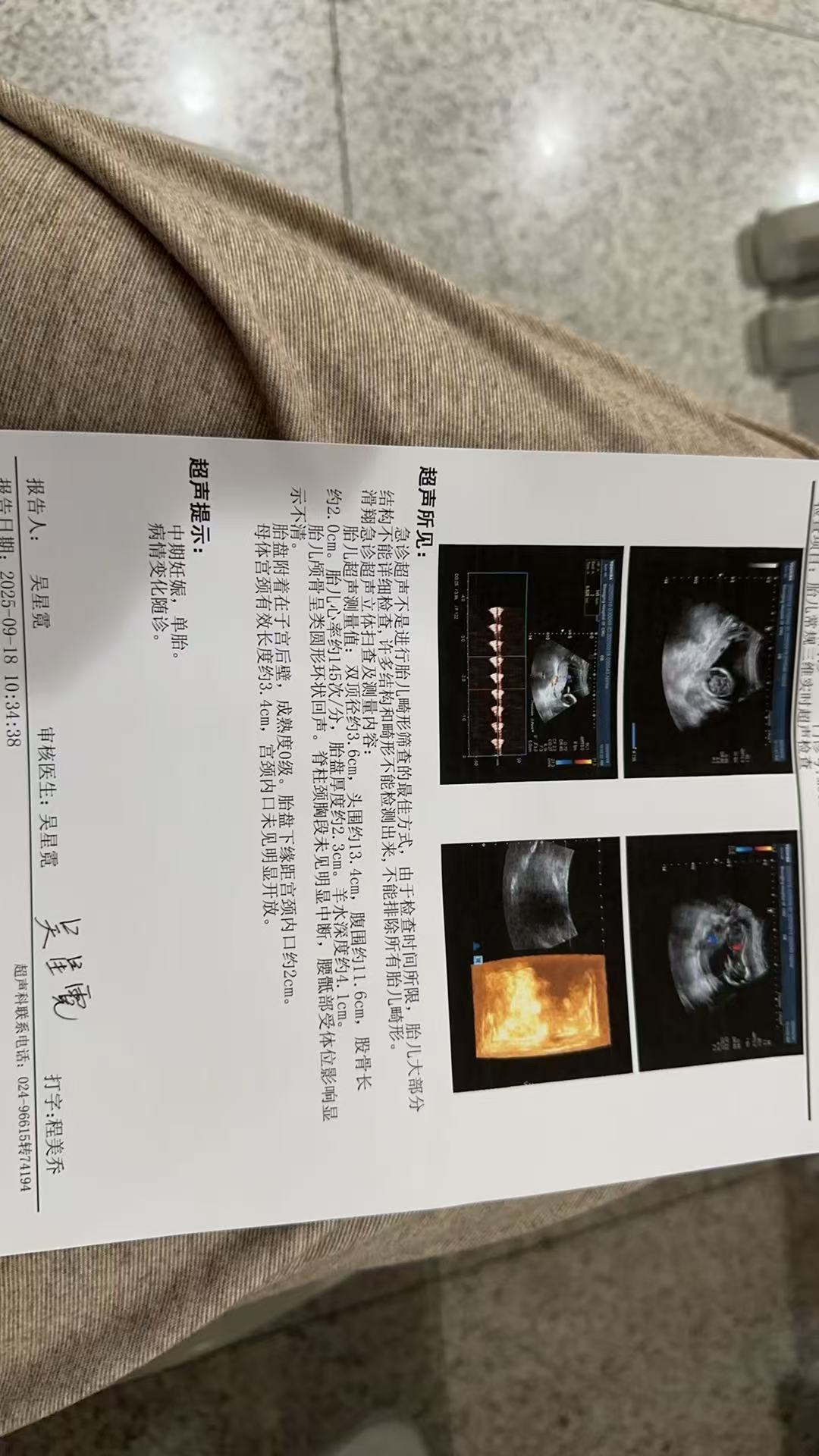 做无创DNA检查需要空腹吗？
