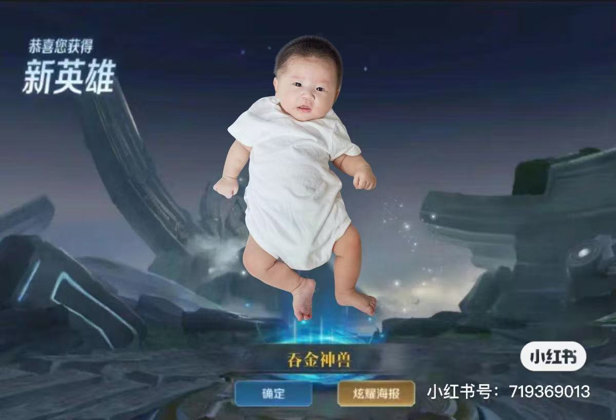 孕期头晕可能是贫血