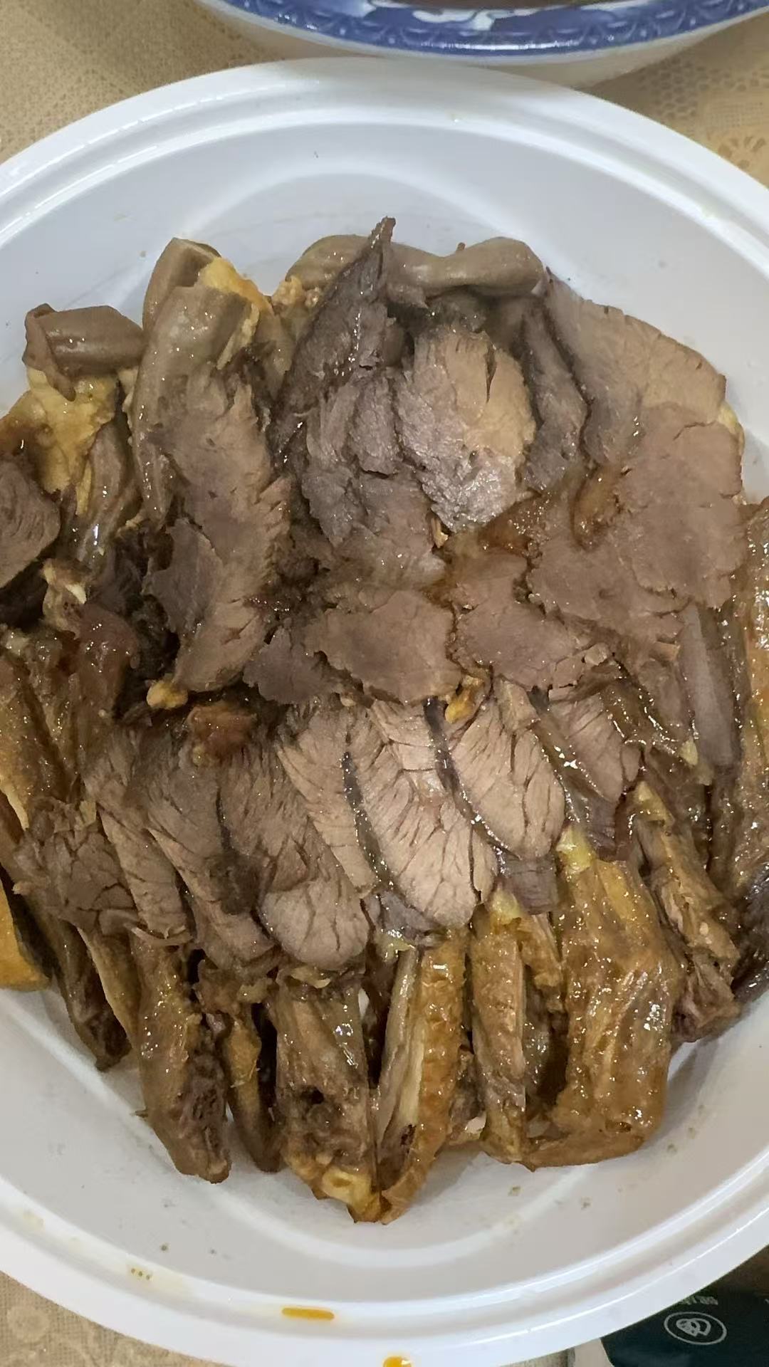 孕期便秘困扰，姐妹们有什么好方法吗？