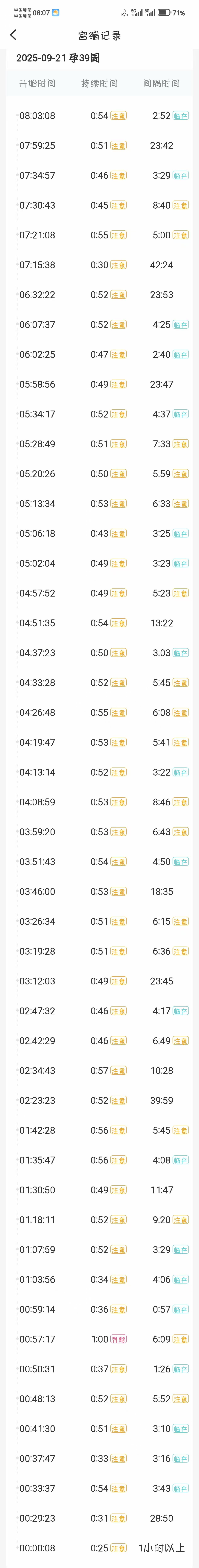 无痛分娩的纠结时刻