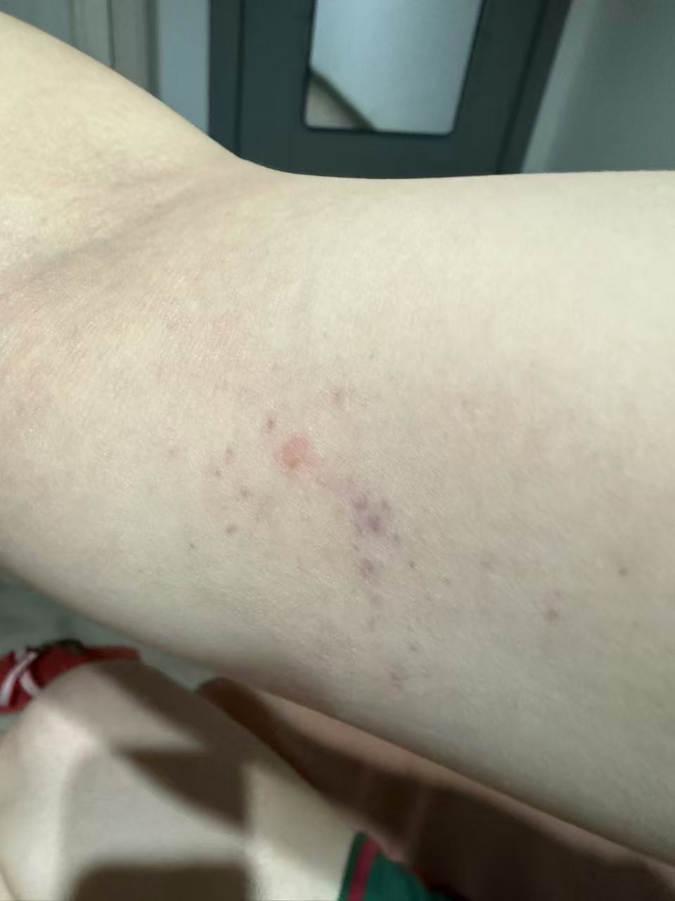 孕晚期内检的恐惧与经验分享