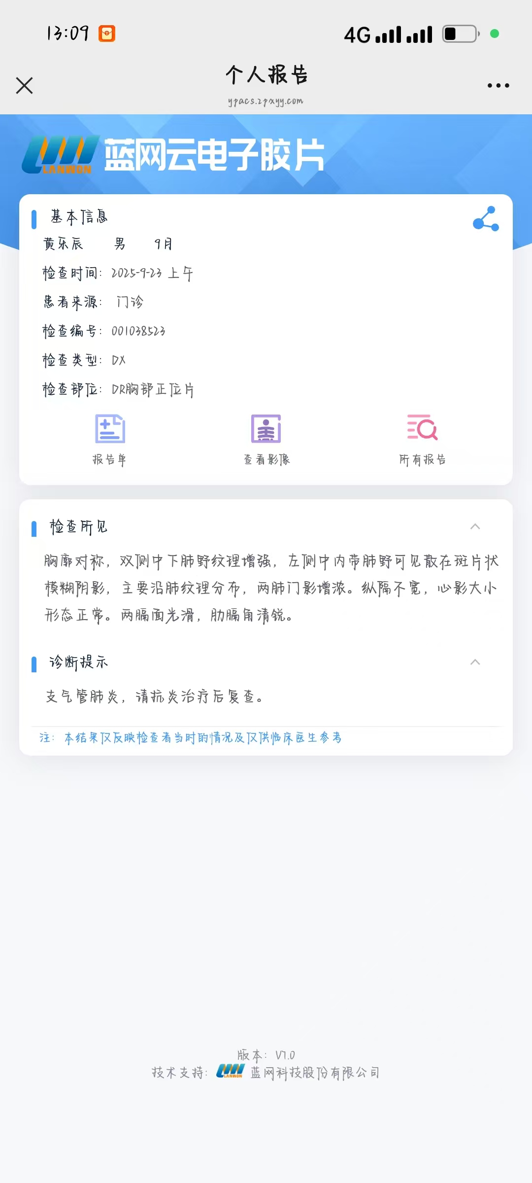 宝宝咳嗽反复不好，原来是支气管肺炎