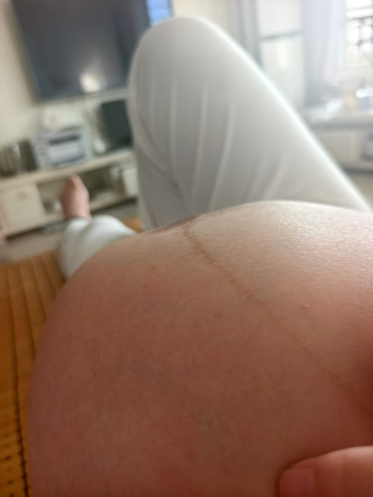孕晚期肚子偏硬和宫缩的困扰