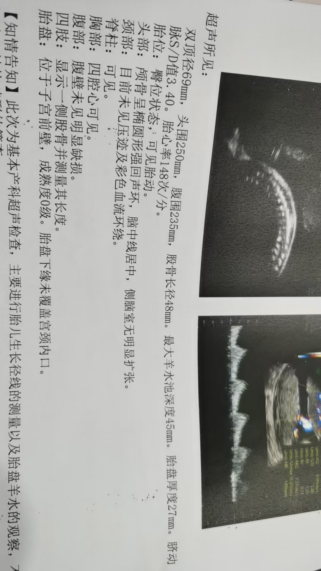 台风天产检记