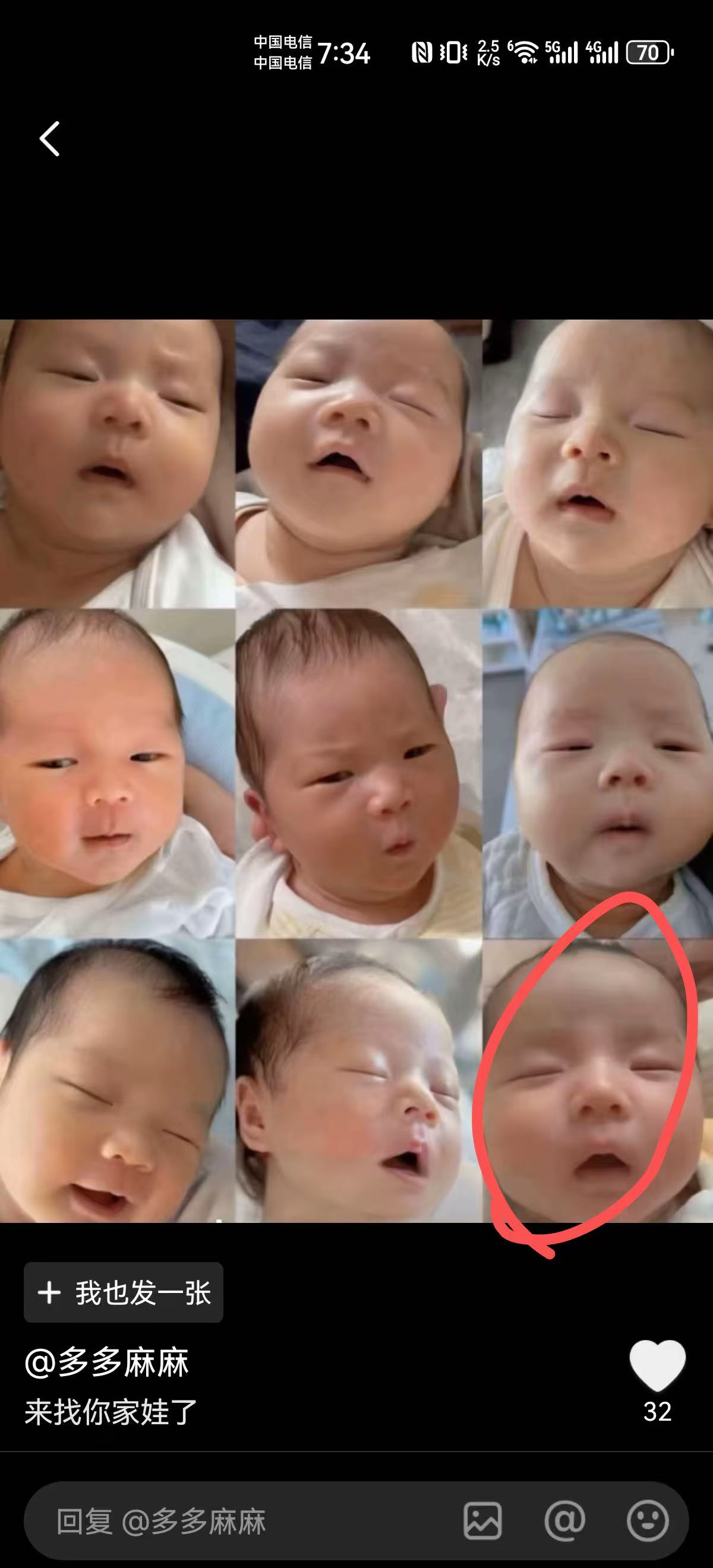 超快顺产却来不及打无痛的惊险经历