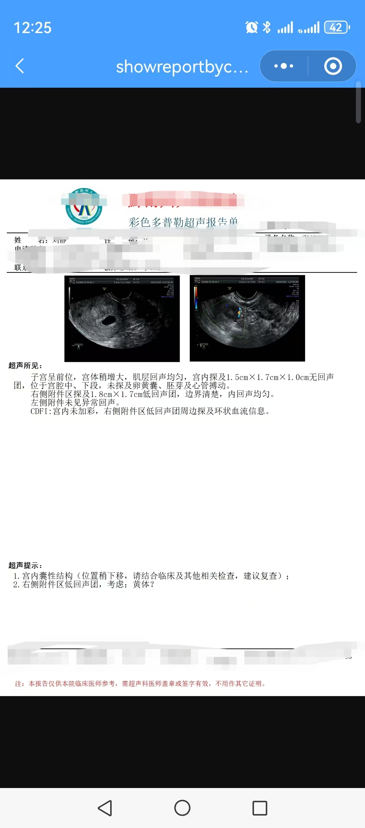 孕早期胎心胎芽出现晚的焦虑