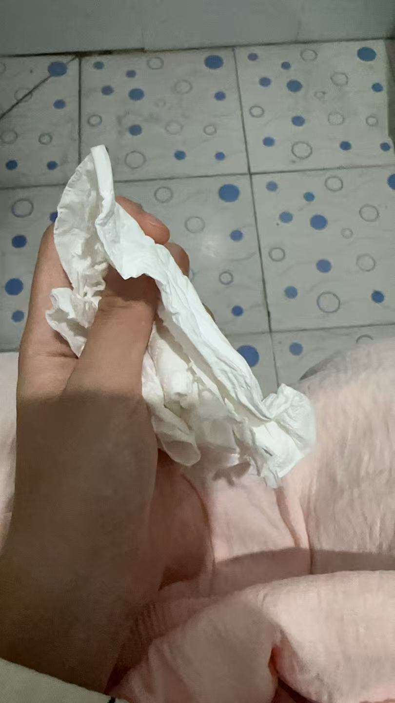 孕期便秘困扰