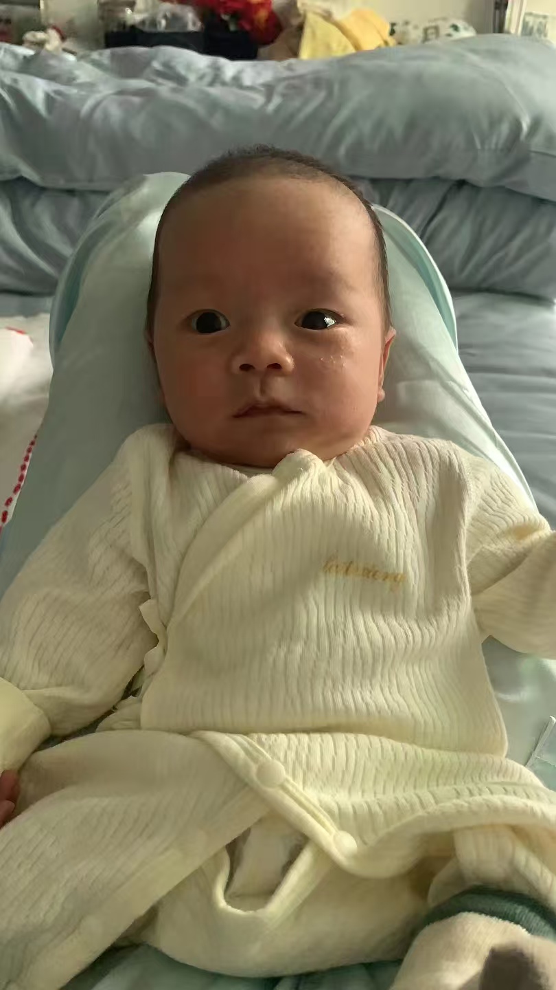 母乳性黄疸的困扰