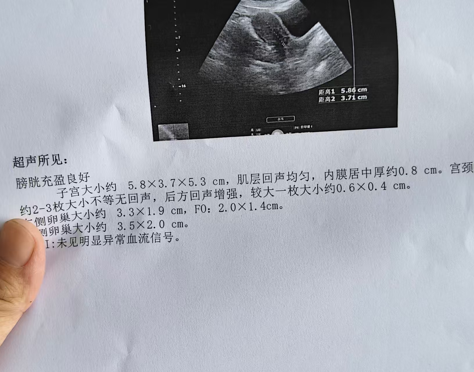 备孕路上的困惑：排卵监测与同房姿势