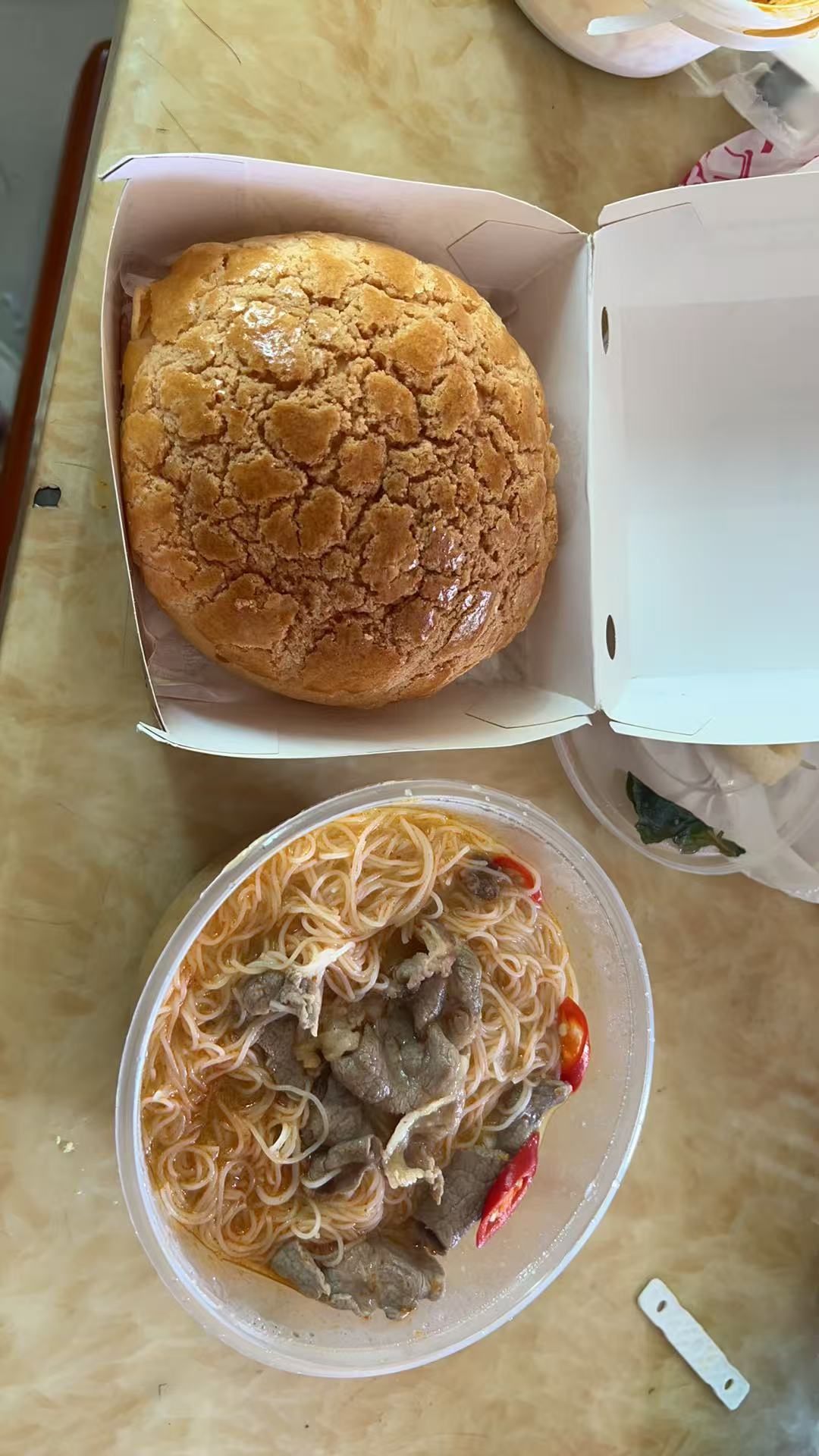 孕期胃部不适的困扰