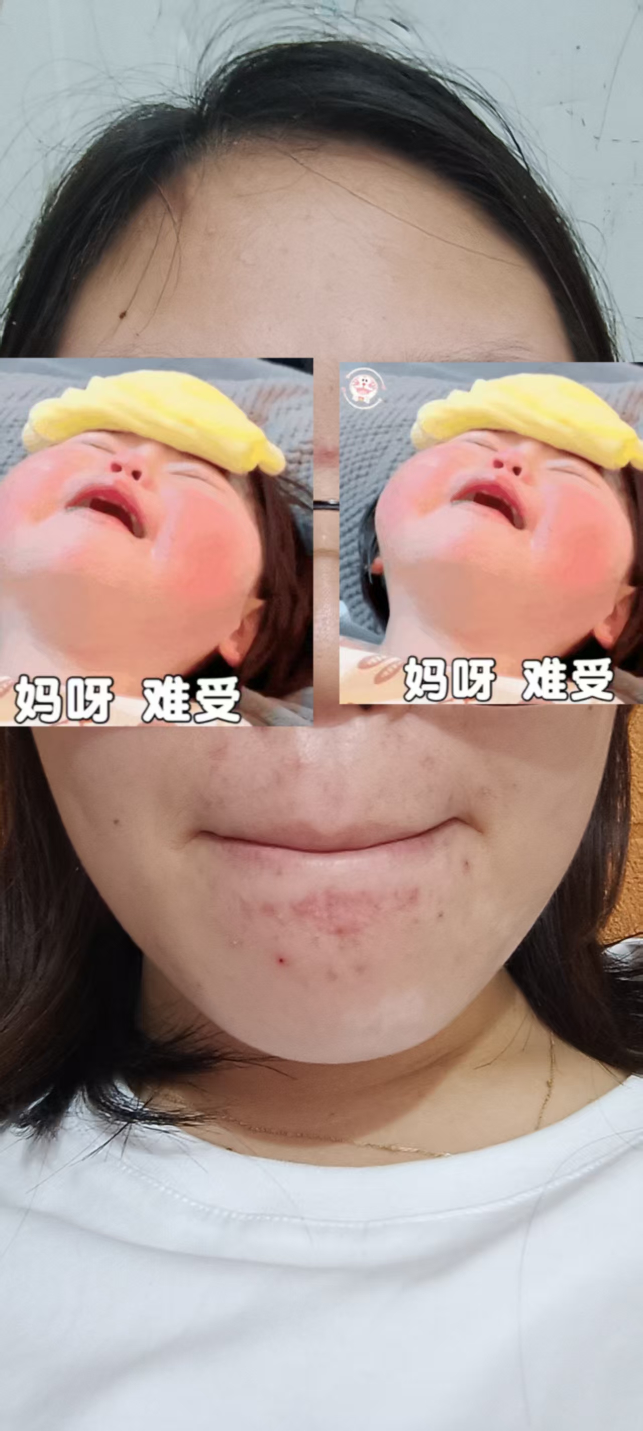 孕早期反应大，姐妹们都是怎么熬过来的？