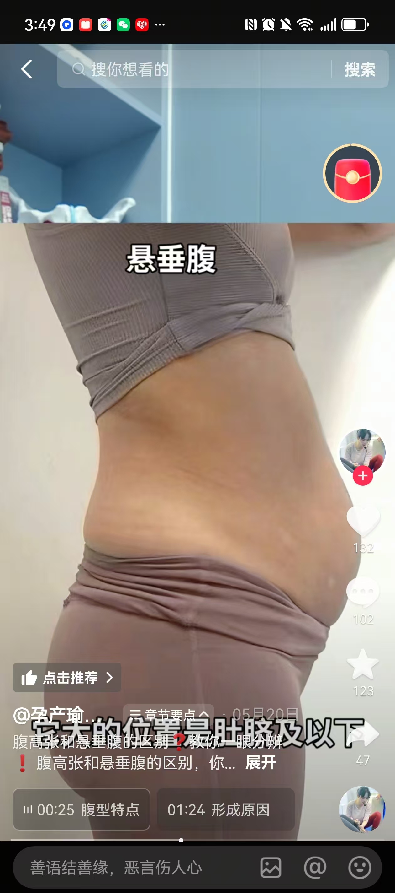 产后腹直肌分离的困扰