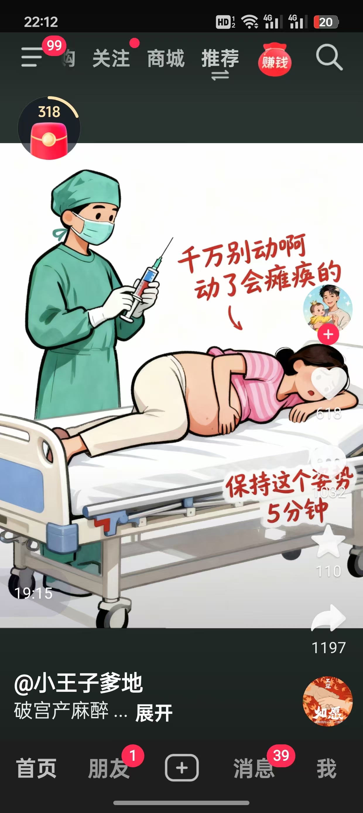 剖腹产后的恢复与护理