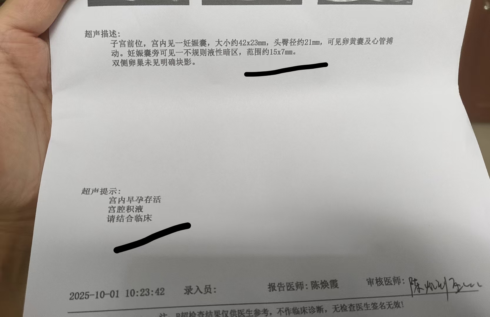 孕早期出血的焦虑与应对