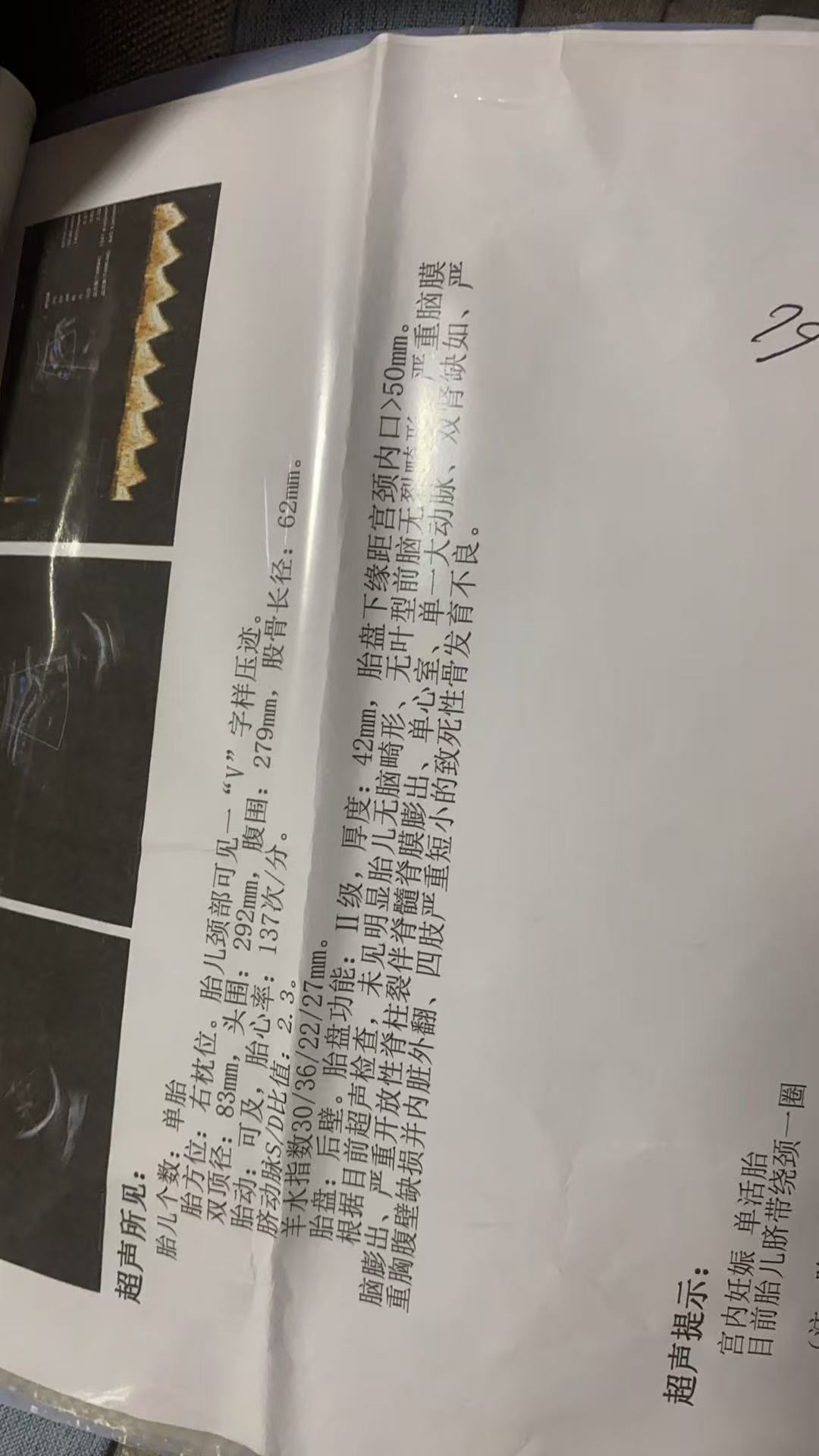 32周胎盘二级正常吗？胎动频繁好担心