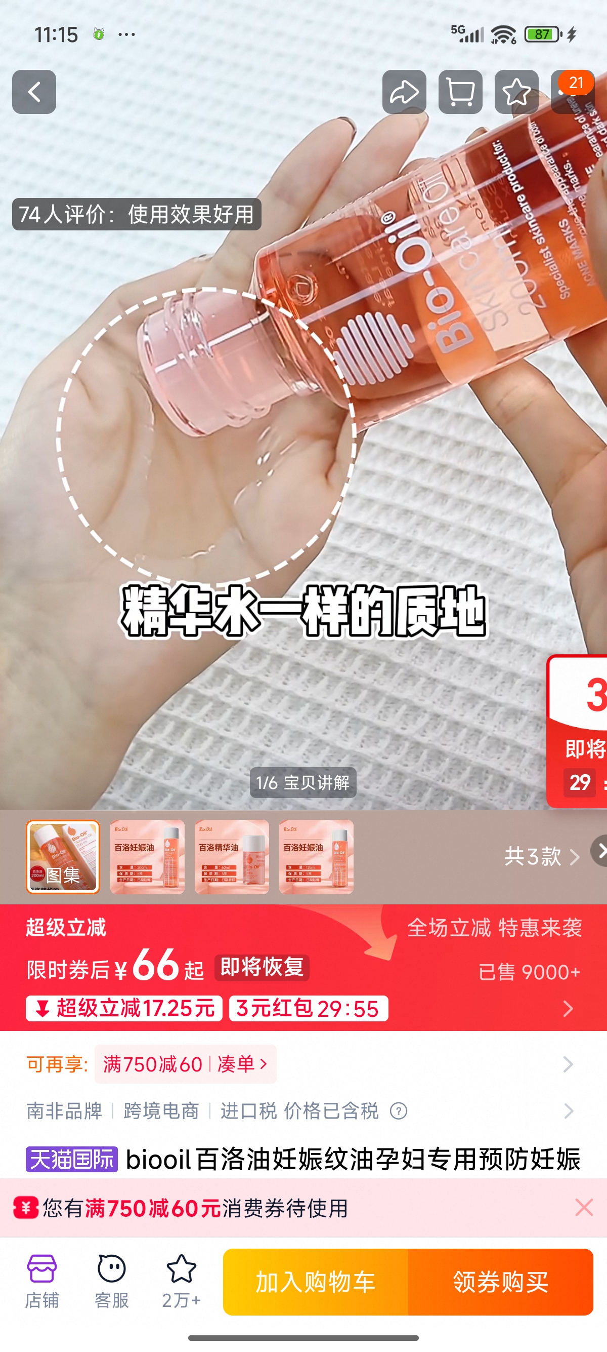 孕期血糖控制与妊娠纹护理分享