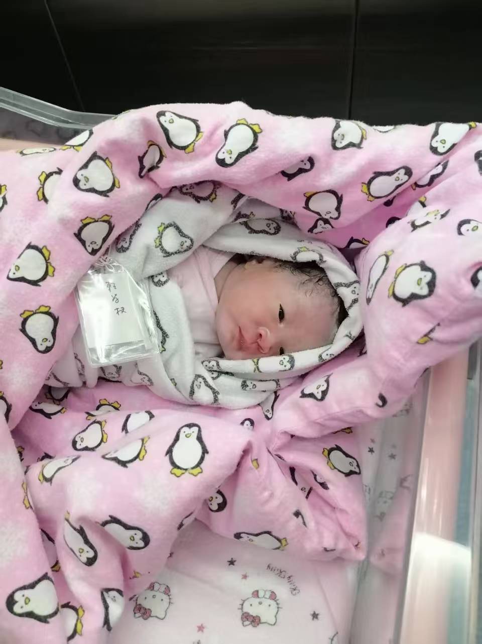 剖腹产前的忐忑与准备