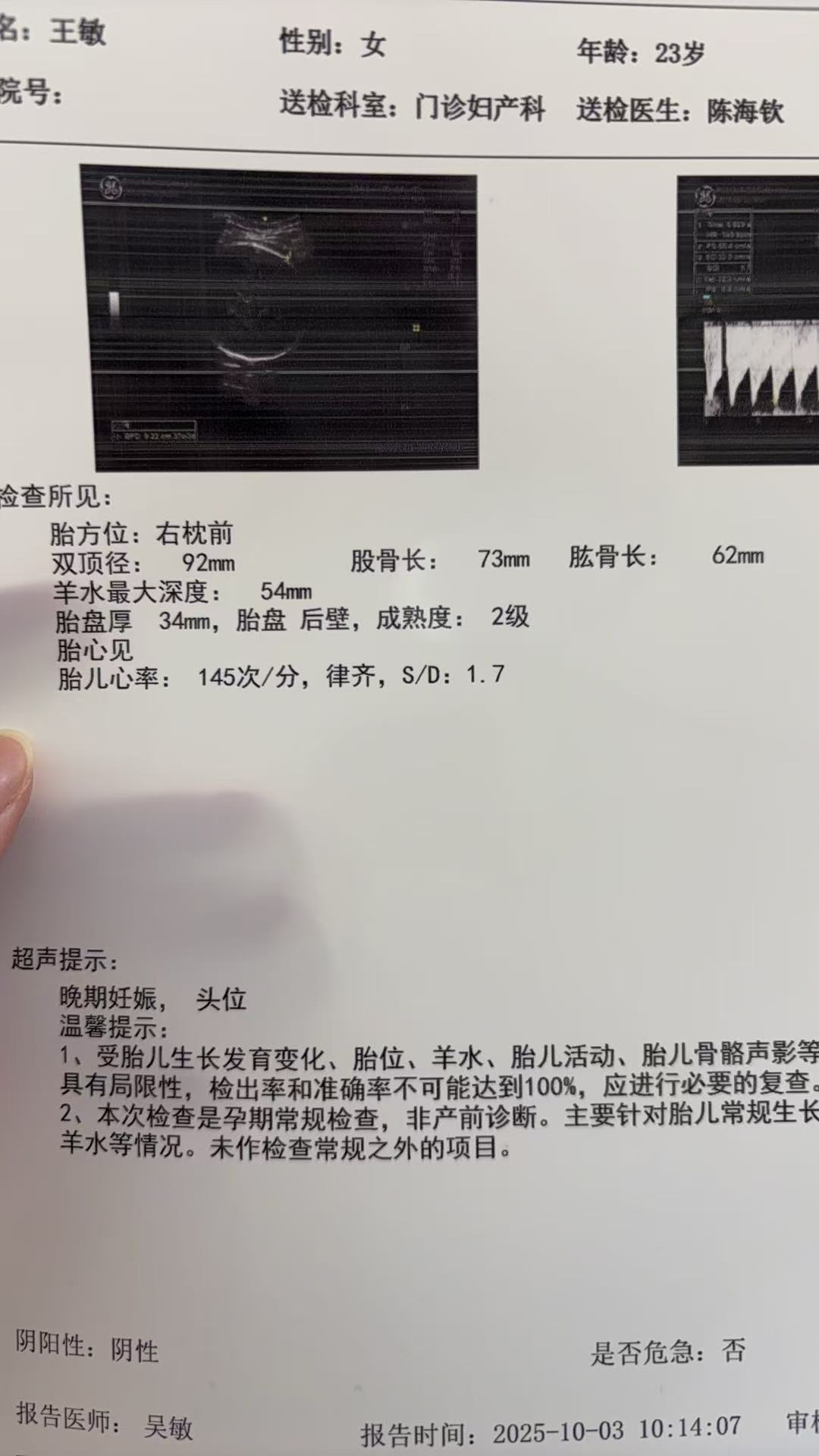 孕晚期胎心监护的忐忑经历